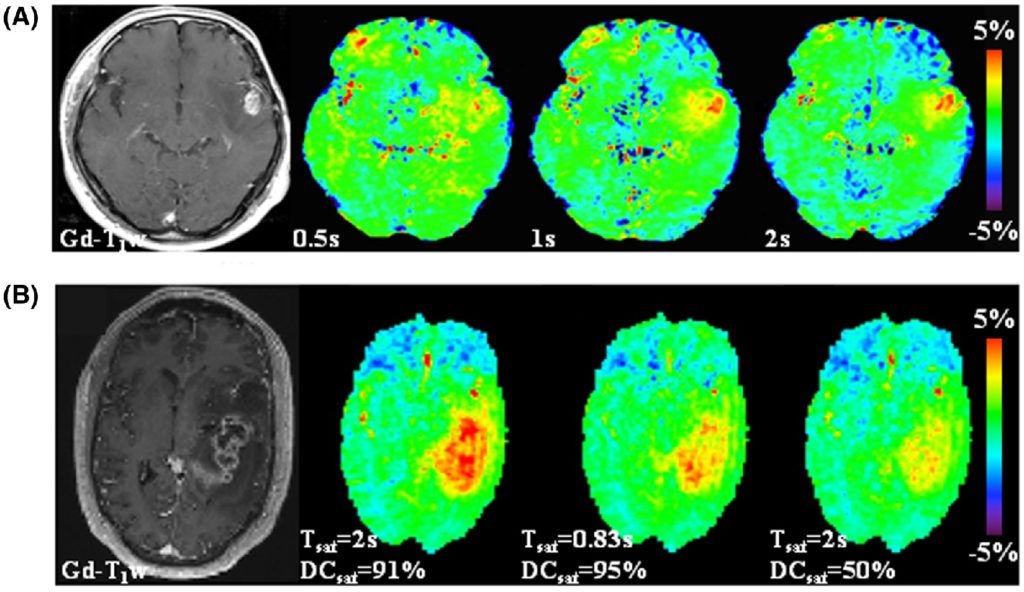 New Paper: Consensus On Clinical Aptw Cest Mr Imaging - Mrt-forschung 