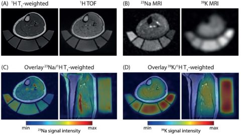 Zum Artikel "New paper: Assessing muscle-specific potassium concentrations in human lower leg using potassium magnetic resonance imaging"