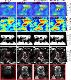 Zum Artikel "Neues Paper: Accelerated B1+ mapping and robust parallel transmit pulse design for heart and prostate imaging at 7T"