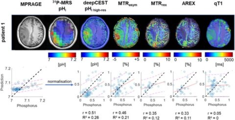 Zum Artikel "Neues Paper: Toward Noninvasive High-Resolution In Vivo pH Mapping in Brain Tumors by 31P-Informed deepCEST MRI"