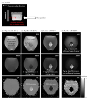 Zum Artikel "Neues Paper: Overestimation of the Apparent Diffusion Coefficient in Diffusion-Weighted Imaging Due to Residual Fat Signal and Out-of-Phase Conditions"