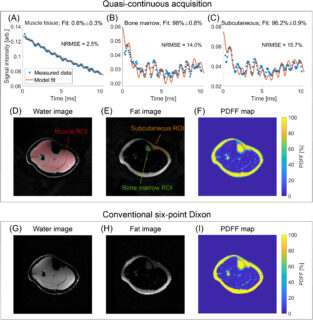 Zum Artikel "Neues Paper: Fat/Water Separation at 7 T Using a 3D Radial Sequence With Quasi-Continuous Echo Times"